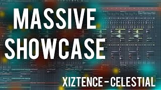 FL Studio 12 | Massive Future House/Bass FLP Showcase | Celestial