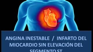 Microvasculares definición de angina