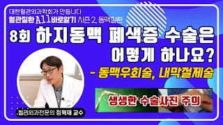※ 수술 사진, 시청 주의 [시즌2, 008편 - 하지동맥 폐색증 수술은 어떻게 하나요?]_동맥우회술, 내막절제술_혈관질환 All 바로알기 캠페인
