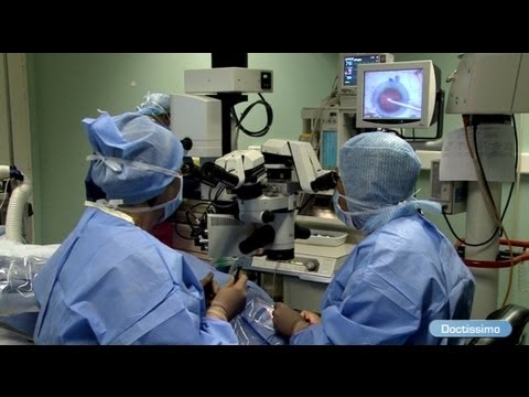 La chirurgie de la cataracte   Droulement de lintervention   Doctissimo   Sant