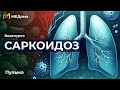 Саркоидоз легких: Патогенез, Симптомы, Лечение и Диагностика | Медома | Подготовка к USMLE Step 1