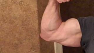 63 year old bicep