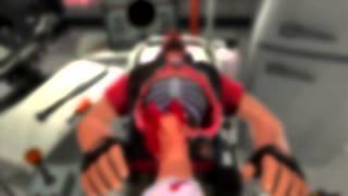 Surgeon simulator 2013 meets team fortress 2 trailer