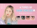 How to remove dark circles under eyes in the most effective way  teen beauty bible