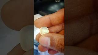 || Metal free tooth ceramic crown || #zirconiumcrowns #viral #ytshorts