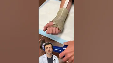 🦵🏽👀Гипс | Как снимают гипс | Осциллирующая пила