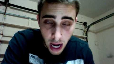 Observe and Report- Postcard From Dennis Impression