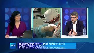 Insertie implanturi dentare pas cu pas. Cand intervine chirurgul maxilo-facial? Prof dr Mihai Juncar