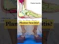Plantar Fasciitis?#viralreels