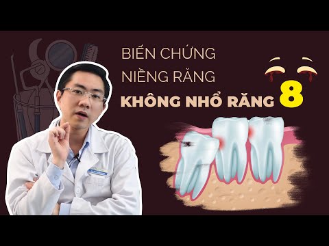 chăm sóc răng miệng để phòng ngừa sâu răng tại Kemtrinam.vn