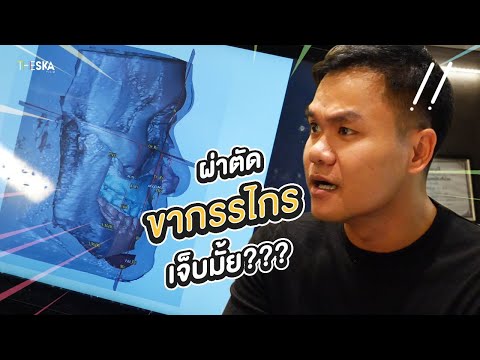 ผ่าตัดขากรรไกรเจ็บไหม?! จัดฟันเดอะซีรีย์ Ep.4