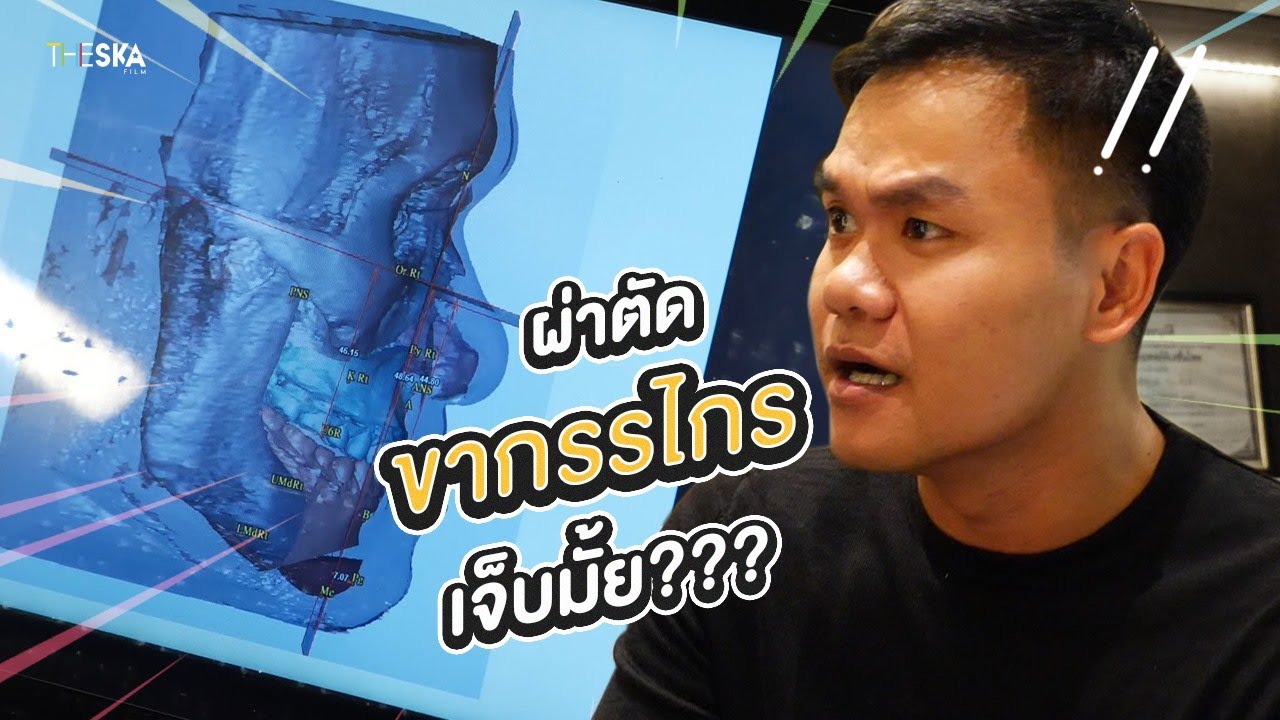 ผ่าตัดขากรรไกรเจ็บไหม?! จัดฟันเดอะซีรีย์ Ep.4