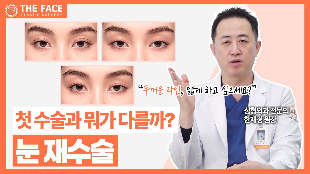 눈 재수술, 왜 더 어려울까? _ 눈 재수술