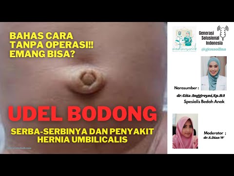 Video: Hernia Umbilikalis Pada Anak