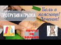 Боль в пояснице. Протрузия, грыжа. Лечение. Кинезиология