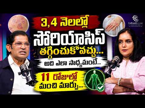 సోరియాసిస్‌తో బాధపడుతున్నారా? 11 రోజుల్లో మంచి మార్పు..4 నెలల్లో.. | Dr Ravi Kumar Chinta Cellhealth