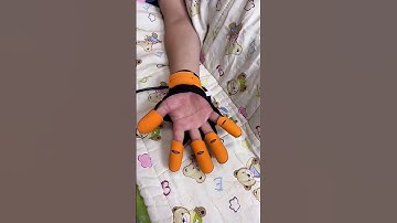 Finger recovery robot 🔥 link in the 📍 comment👆#shorts #gadgets#us