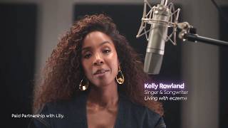 Ebglyss Commercial (2026) Featuring Kelly Rowland