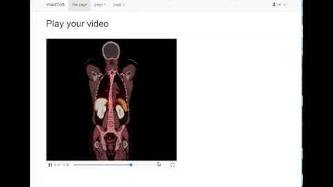 medical radio DICOM  dcm image to MP4 video