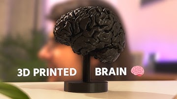 From MRI to 3D Print: My brain in plastic