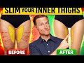 The Science of Thigh Fat: Why It’s Not Just Under the Skin