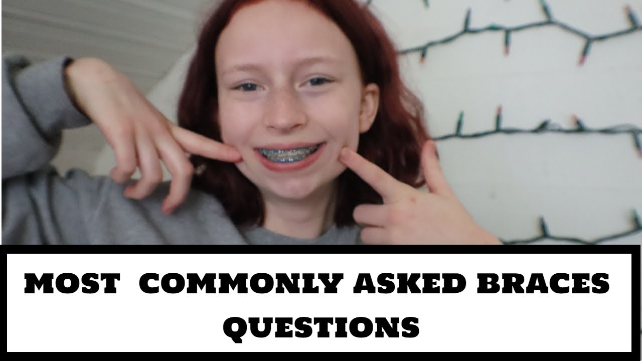 Commonly Asked Braces Questions Braces Q&A YouTube