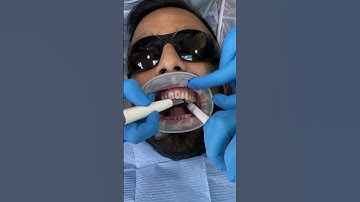 GBT Airflow Dental Hygiene Treatment Stain Removal