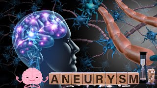 Brain Aneurysm: Causes, symptoms, Treatment & Prevention Tips #shorthealthtips #aneurysms