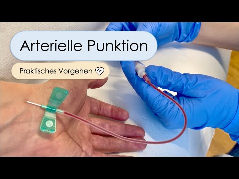 Video: Wie man eine Punktionswunde behandelt (mit Bildern)