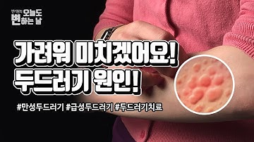 너무 가려워 밤잠을 설치게 만드는 두드러기 원인과 치료방법