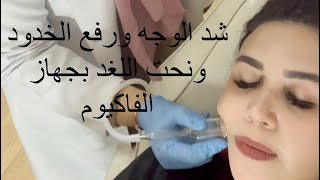 شد الوجه بالفاكيوم والrf لتحديد الذقن ورفع الخد وعلاج اللغد  نضارة تجميل_نساء