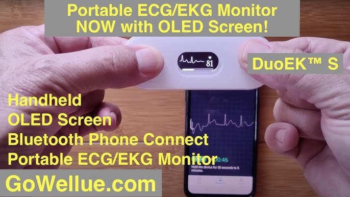 Wellue Smart Blood Pressure Monitor (BP + ECG)