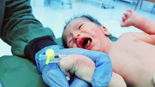 تركيب كانيولا للاطفال  IV cannula insertion for baby 
