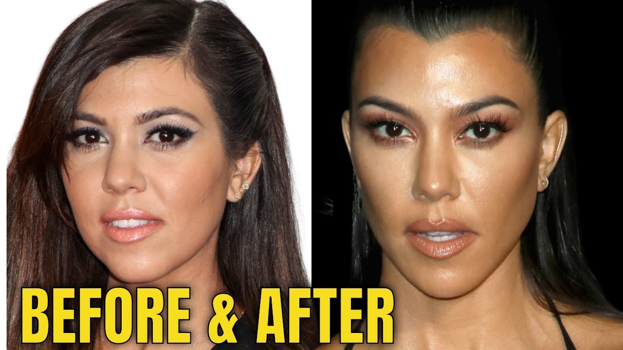 Kourtney Kardashian: Plastic Surgery: Is She Trying To Look Like Kim?