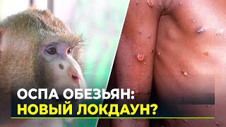 Оспа обезьян: чем опасна, кто в группе риска и как передаётся человеку