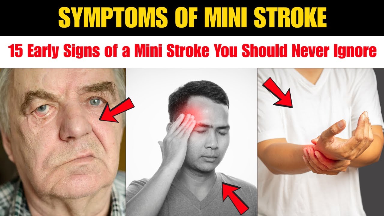 15 Early Signs of a Mini Stroke You Should Never Ignore | Symptoms of Mini Stroke