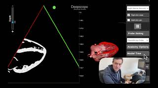 Deepscope Mannequin Update