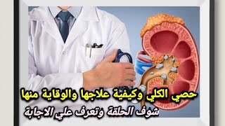 #شاهدوا حلقة عن#حصي_الكلي #والمغص_الكلوي وأزاى تتخلص منهم وتعالج نفسك