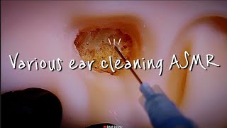 ASMR For you who can't sleep...★ From soft to intense!!! Various ear cleaning(No talking)