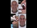 The Ultimate Reveal | High-End Smile Transformation