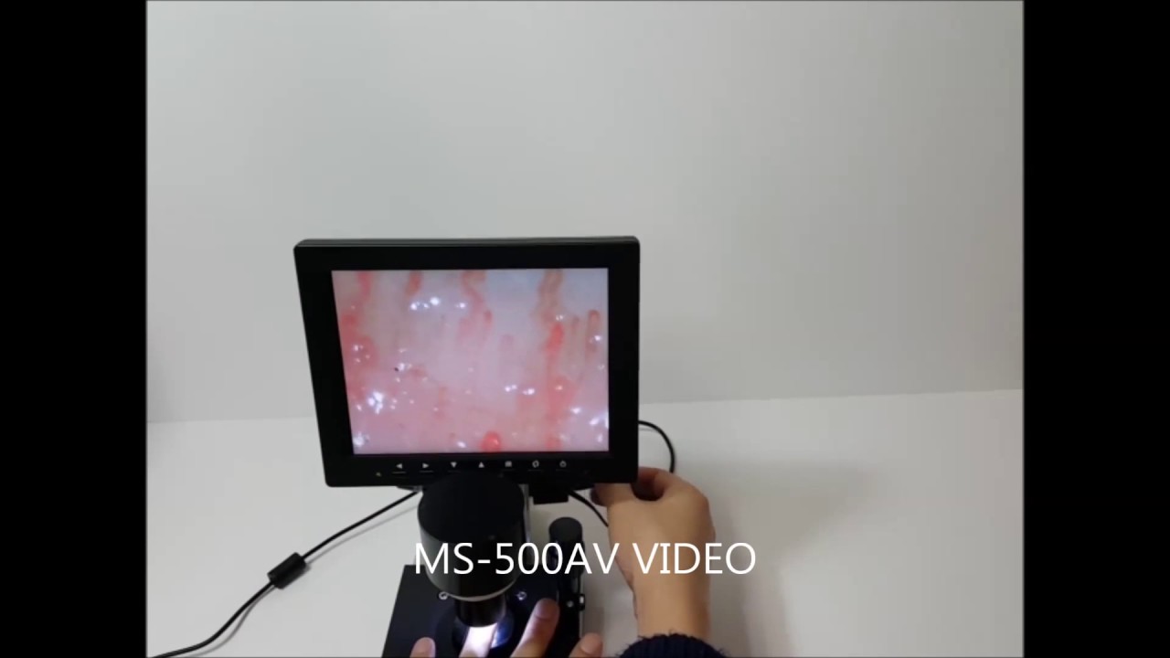 Diagnostika Fohow kapiliaroskopu. Капиляроскоп. Capillary Microscope