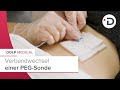 Verbandwechsel PEG Magensonde Eine PEG Sonde Richtig Verbinden I DOLPEDIA Verbandwechsel PEG Magensonde Eine PEG Sonde Richtig Verbinden I DOLPEDIA