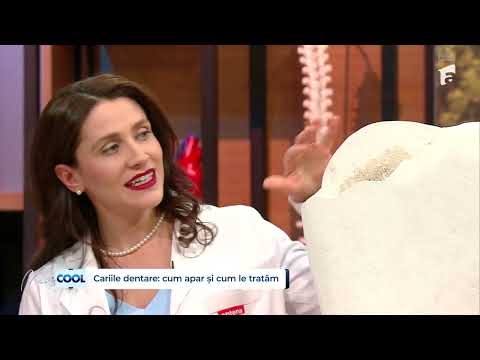 Cauzele apariției cariilor dentare | Stomatologul Alina Scorțea ne spune cum le putem trata
