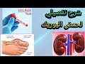 شرح تفصيلي لحمض اليوريك   وأسباب الزيادة والنقصان وماهو مرض النقرس 