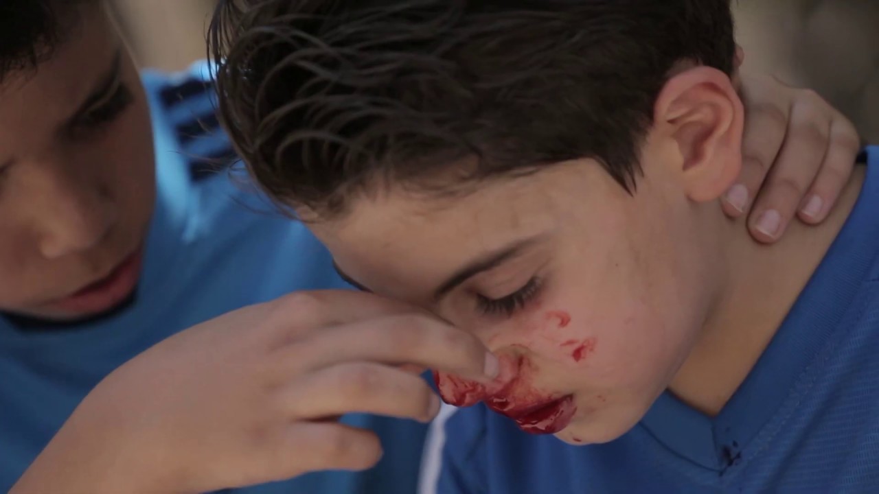 كيفية التعامل مع نزيف الأنف