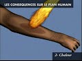 Causes des incendies