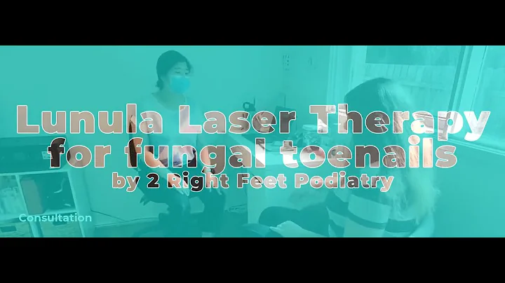 LASER THERAPY FOR FUNGAL TOENAILS at 2RF