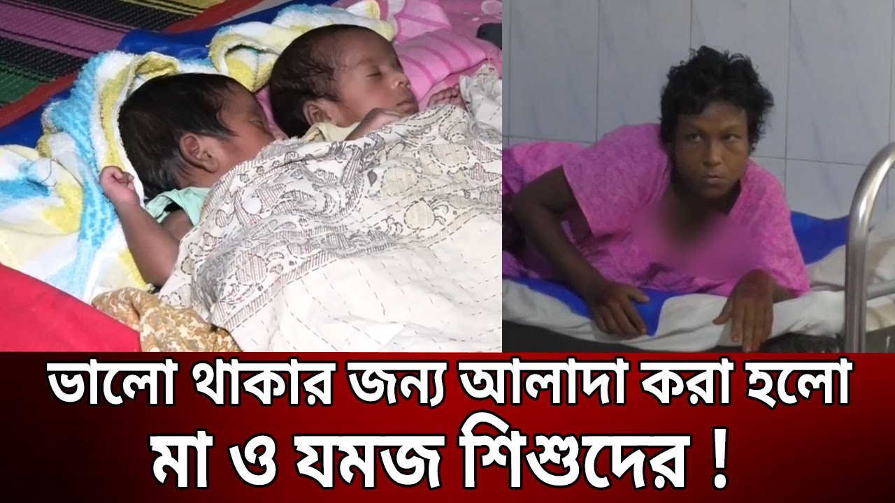 ভালো থাকার জন্য আলাদা করা হলো মা ও যমজ শিশুদের ! Jessore Twin Child