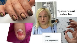 : NAIL VLOG 34:     .  !  