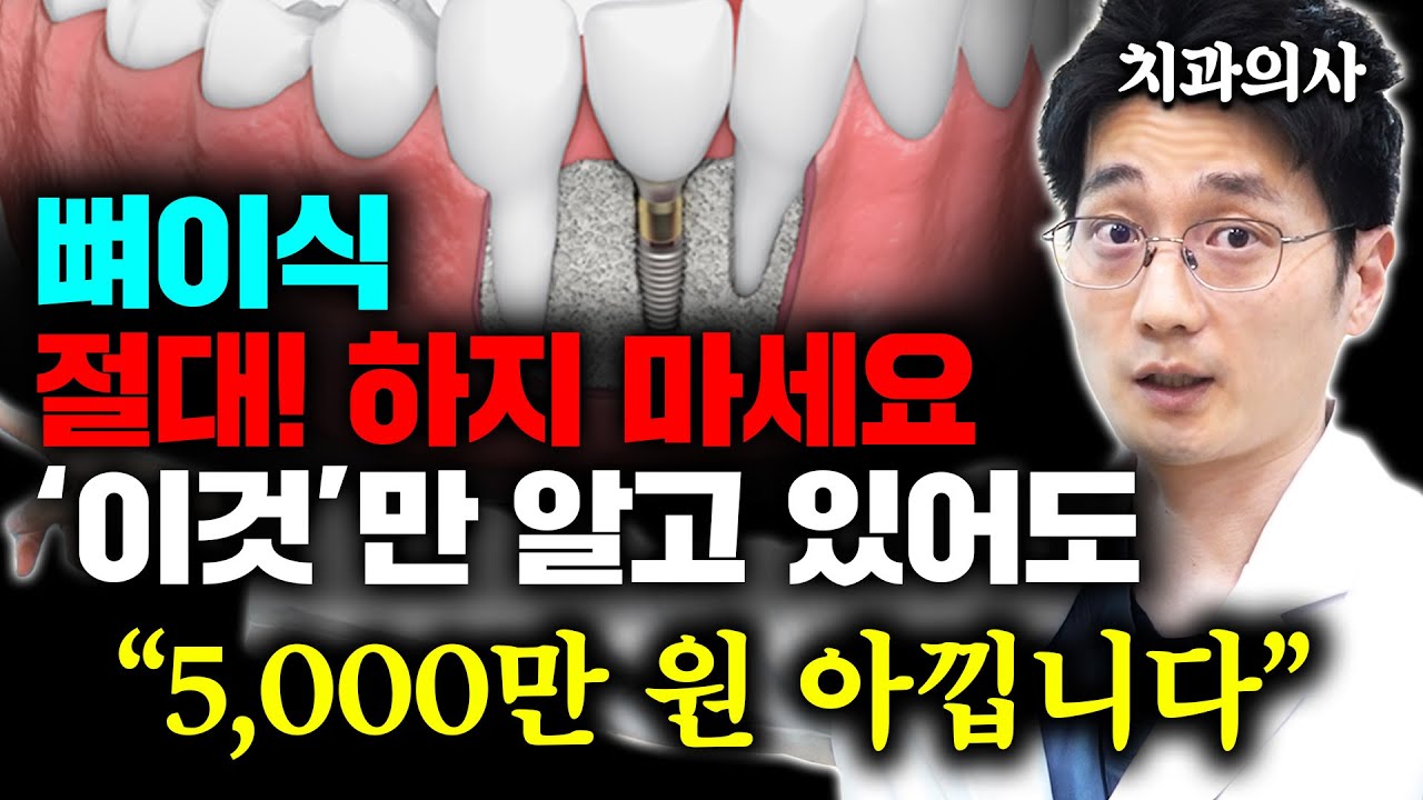 뼈이식 임플란트 